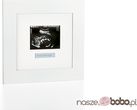 Sonogram Frame White- Ramka Na Zdjęcie Usg